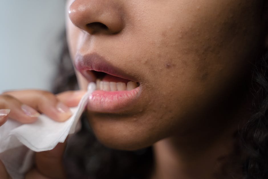 lip filler surgery — Lip Filler Surgery: Informational Guide & Basics
